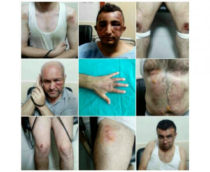 Şahitleri OHAL’de işkenceyi anlattı