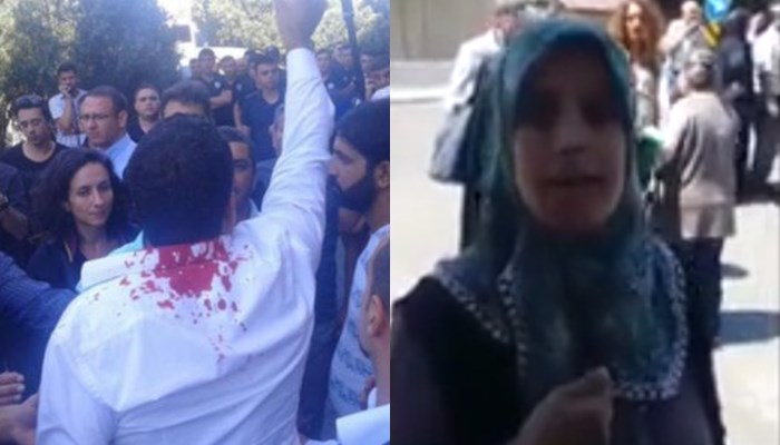 Polis Reyhanlı ailelerini dövdü, “Sizi HDP’liler sandık” dedi