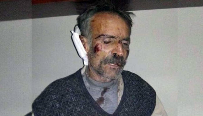 14 gün süren işkenceyi anlattı: Buz tutan zeminde panzerin arkasına bağlayıp sürüklediler!