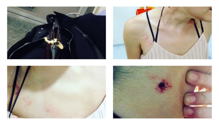 Kadın müzisyene, polisten metroda tekmeli yumruklu işkence! [VİDEO]