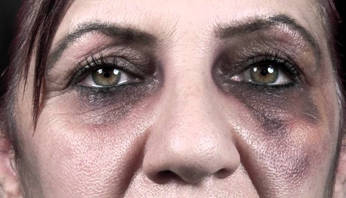 Türkiye’de 120 bin şiddet mağduru kadın 30 elektronik kelepçe ile korunuyor!