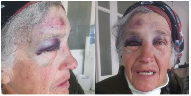 İşini geri isteyen Perihan Nine’yi polis böyle darp etti!