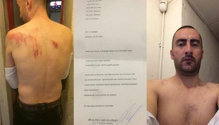 Türkiye’nin Rotterdam Başkonsolosluğu’nda işkence