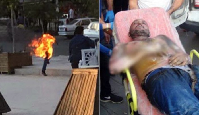 İşsiz genç ‘açım’ diyerek kendini yaktı