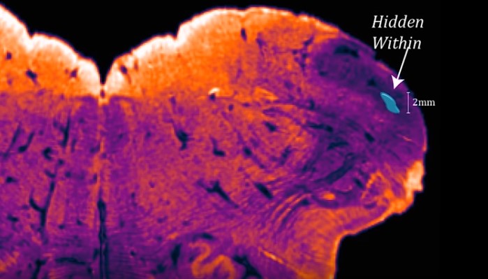 İnsan beyninde daha önce bilinmeyen bir bölge keşfedildi