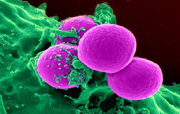 İngiltere’de kanser hücrelerine sızan ilacın denemeleri başarılı oldu