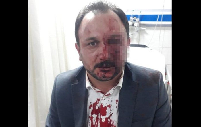 Sendika Başkanı: İstifa etmedim diye dövdüler… Ülkü Ocakları: O bir tecavüzcü