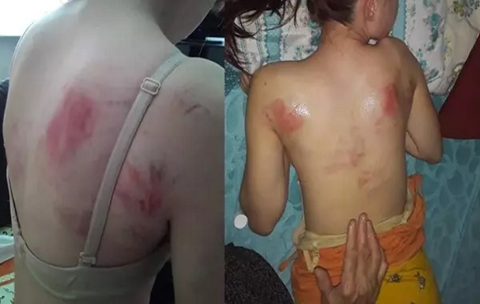 Telefon şifresini söylemeyen 14 yaşındaki kızını ingiliz anahtarıyla dövdü
