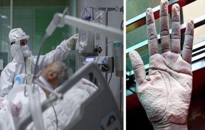 sağlık-çalışanları-salgın