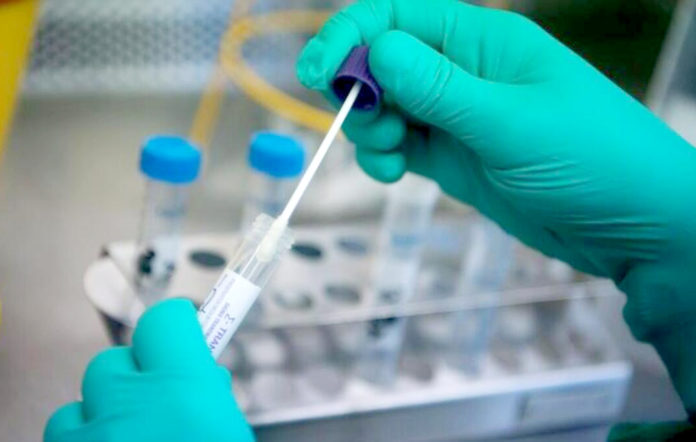 pcr-testi