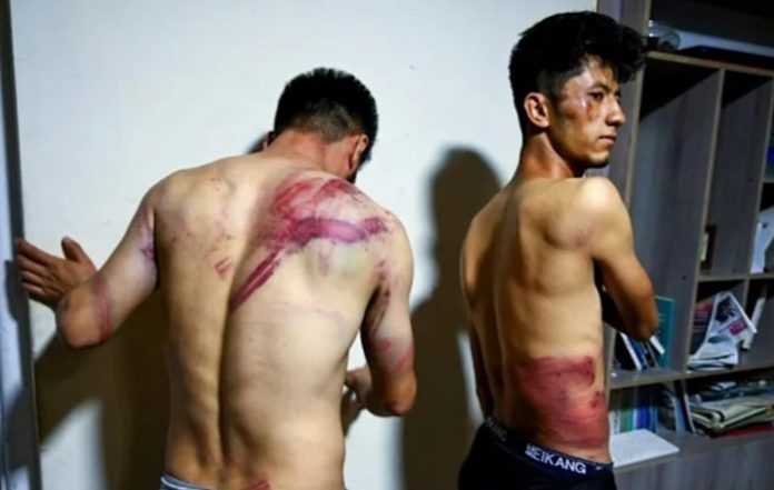 afgan gazeteciler, işkence