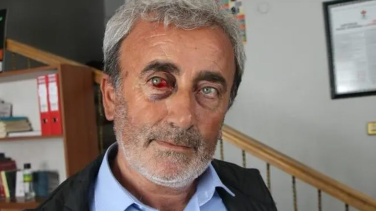 Valilik işkenceyi 20 gün sonra reddetti: ‘İthamlar jandarmanın moralini bozmaya yönelik’