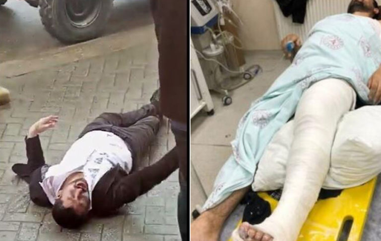 HDP’li vekil Habip Eksik: Ayağım kırıldı dememe rağmen polisler üstüne basıp tekmeledi