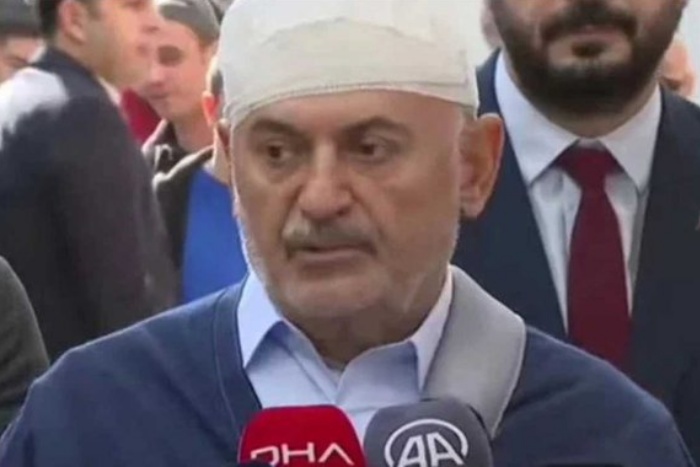 Binali Yıldırım taburcu edildi: Bir kaç takla attık, iki kaburga kırığım var