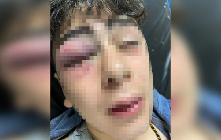 Diyarbakır’da çocuğa işkence davasında sanık polislere ceza talebi