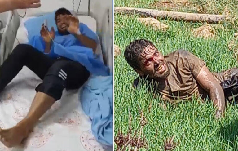 Şanlıurfa’da tedavi gören kuduz hastası hayatını kaybetti