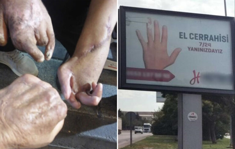 9 işçi elini 1 işçi hayatını kaybetti; iş güvenliği yerine fabrikanın girişine el cerrahisi reklamı kondu