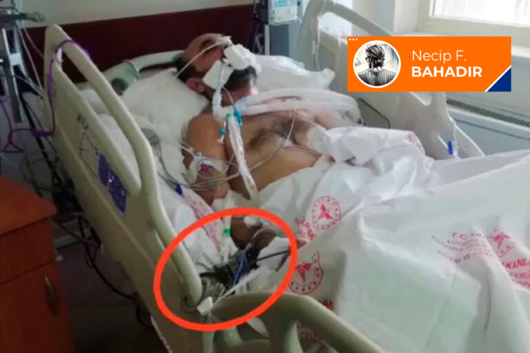 Utanç fotoğrafı!