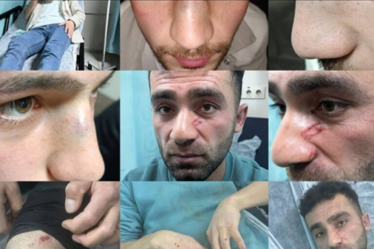 Hakkari’de sivil polis aracını sollayan 4 gence çıplak arama işkencesi ve darp