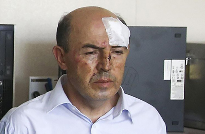 ‘İşkence’ suç değil mi; savcılık, somut delillere rağmen “Kovuşturmaya gerek yok” dedi!