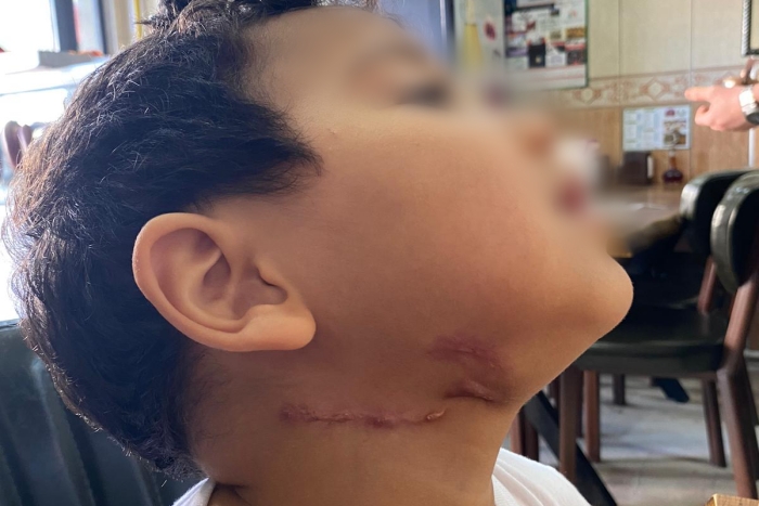 Verem tedavisi gören Selman’ın anne-babası tutuklandı