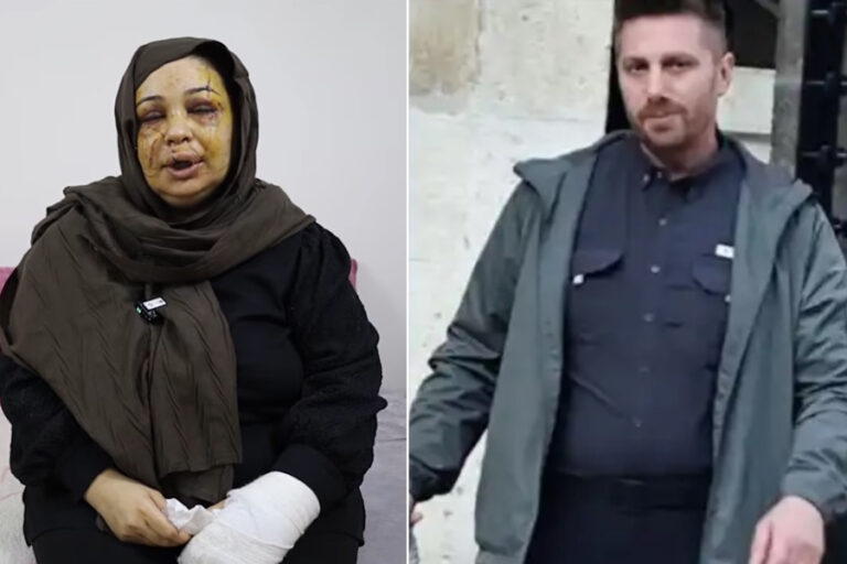 Eşine kesici aletlerle işkence yapan Cumhurbaşkanı koruması serbest bırakıldı