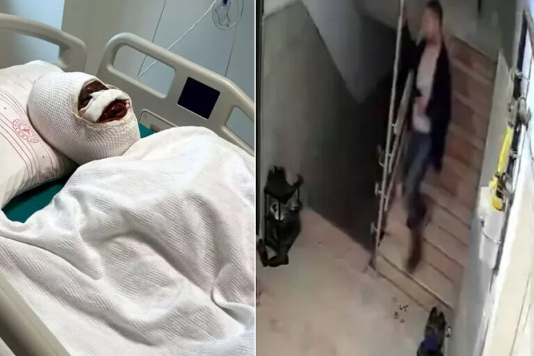 Boşanma aşamasındaki eşini koli bandıyla bağlayıp başından aşağı kezzap döktü