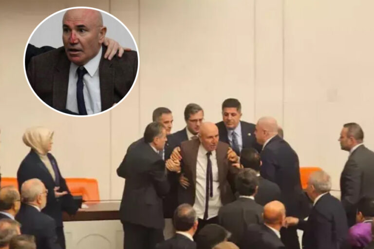 Meclis’te kavga: AKP’lilerin saldırısında burnu kırılan Mahmut Tanal hastaneye kaldırıldı